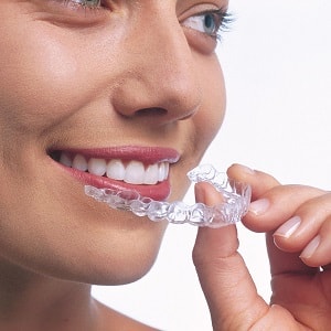 Invisalign i7