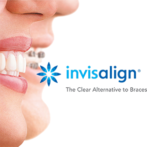 invisalign