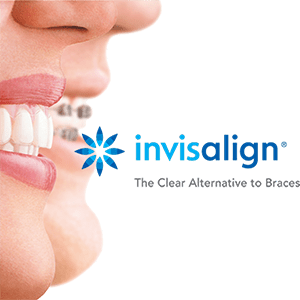 Invisalign